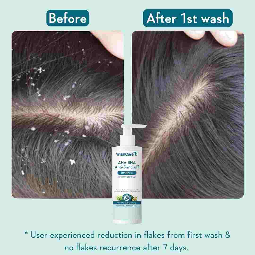 AHA BHA Anti-Dandruff Shampoo - Image 4