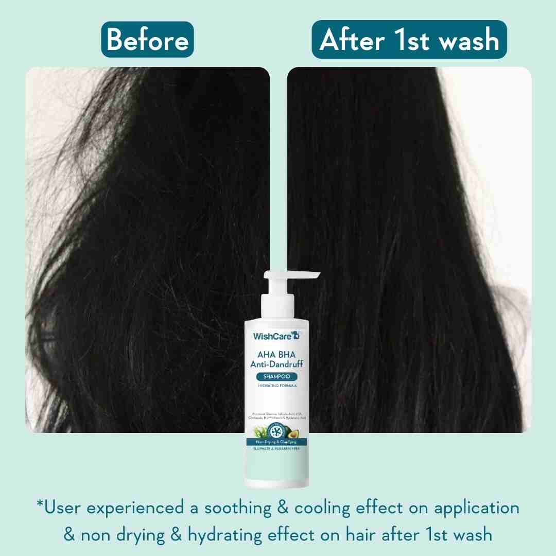 AHA BHA Anti-Dandruff Shampoo - Image 5