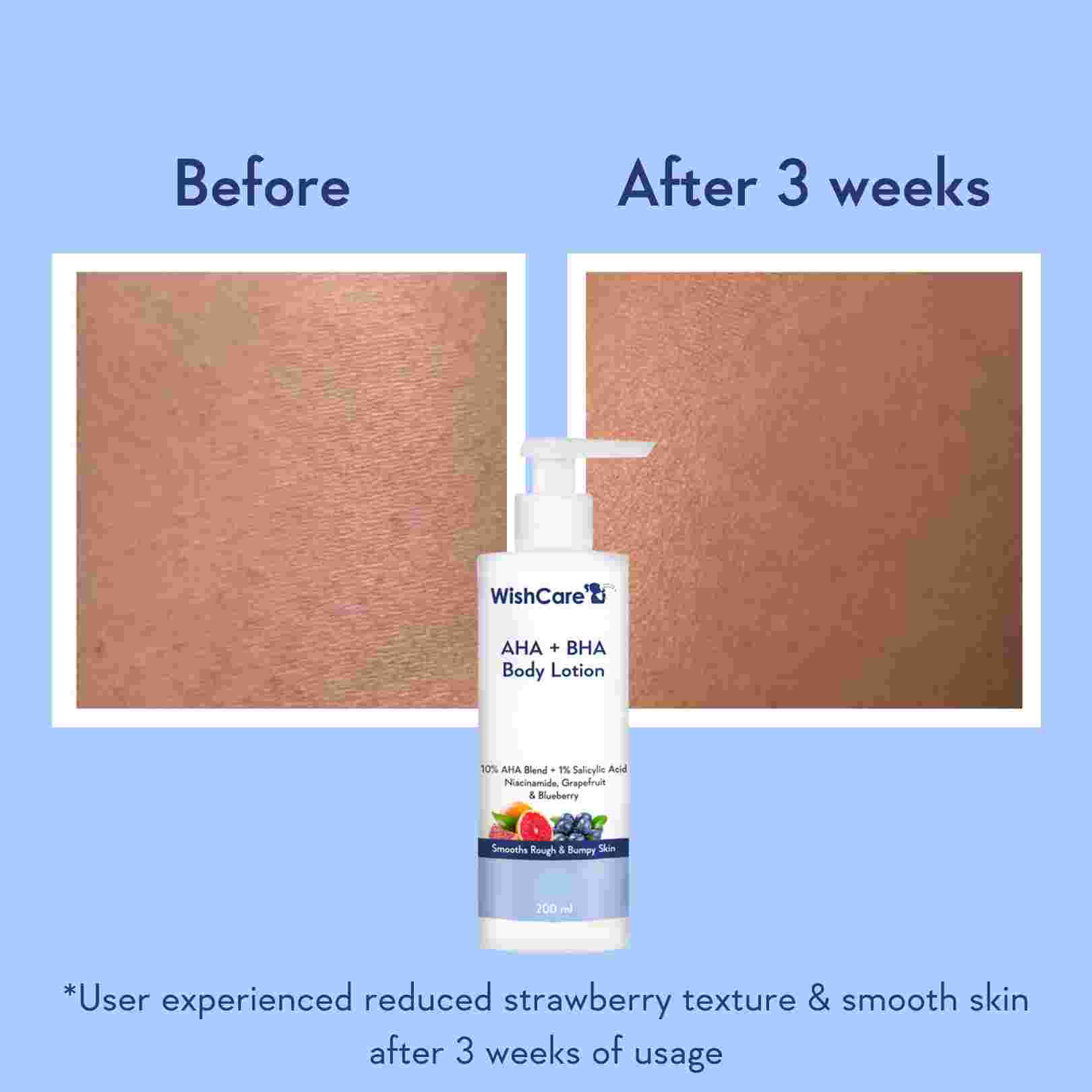 AHA + BHA Body Lotion - Image 3