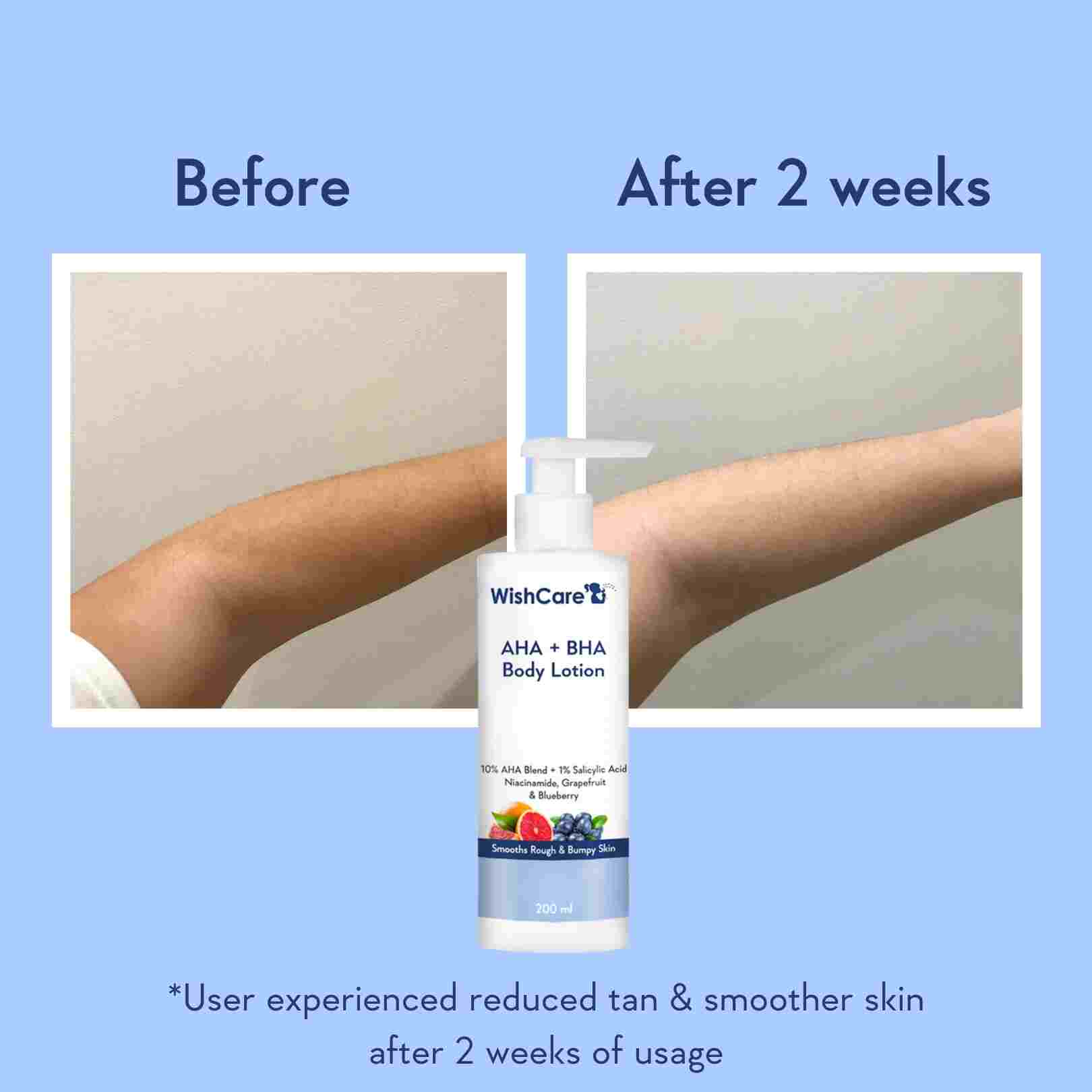 AHA + BHA Body Lotion - Image 4