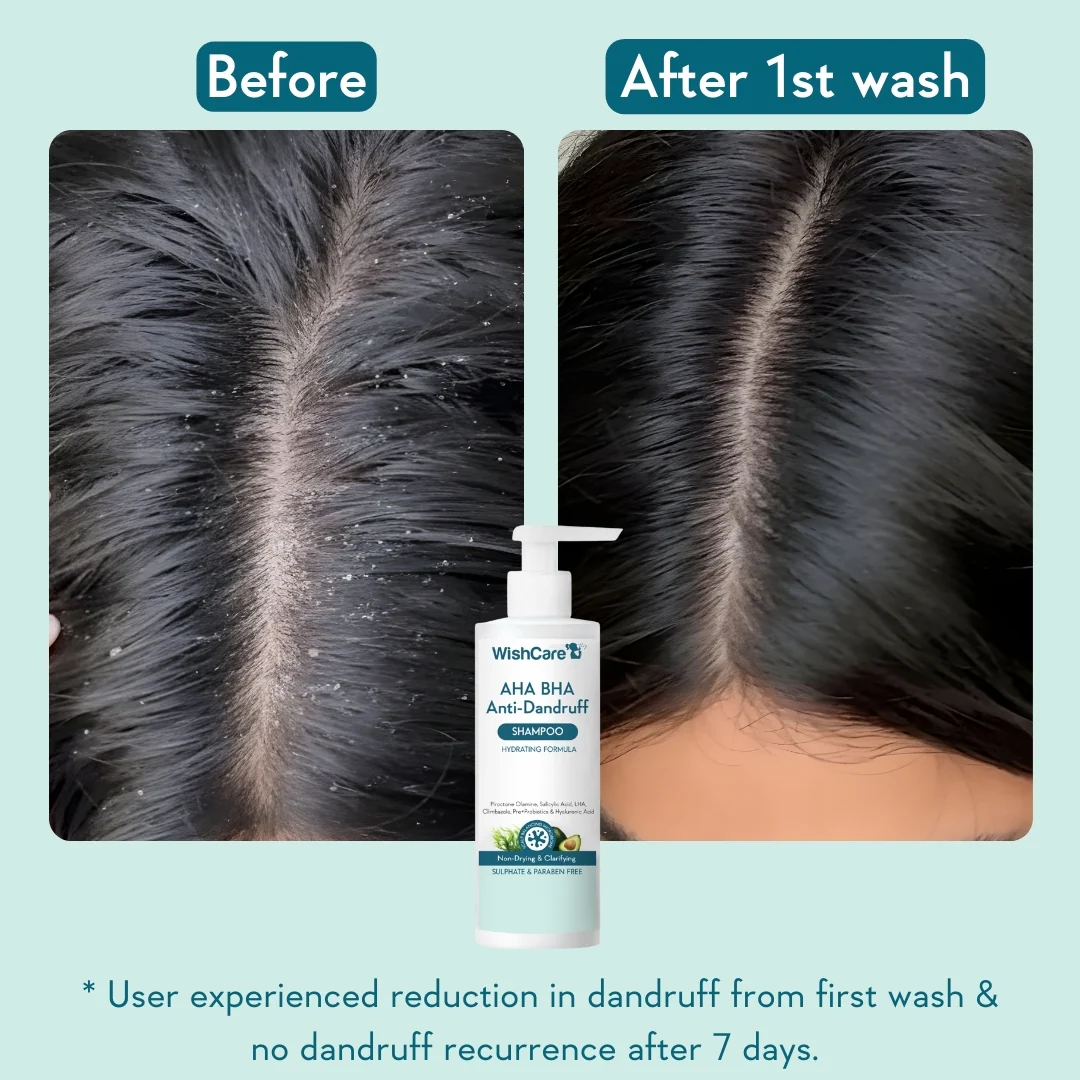 Anti Dandruff Duo - Image 3