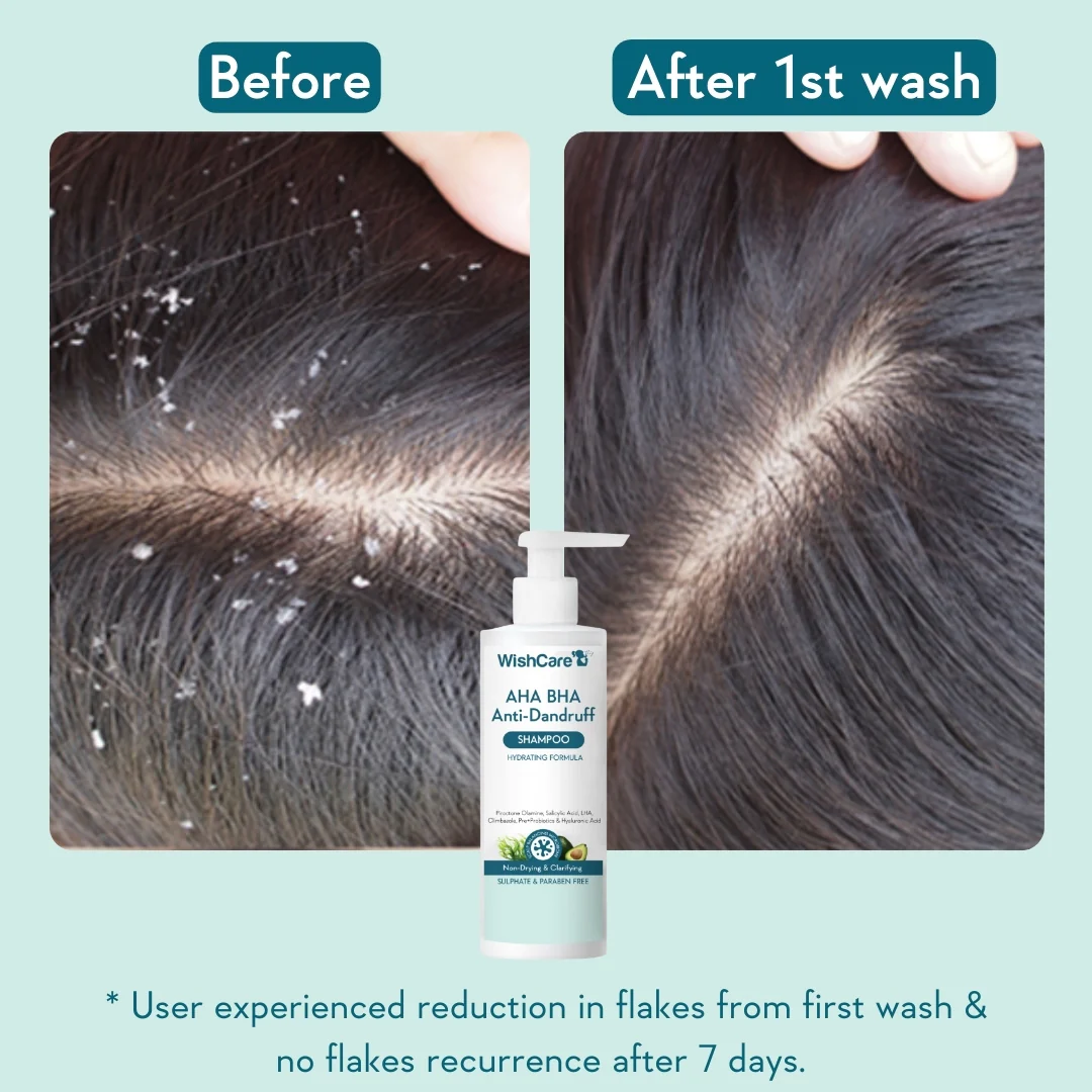 Anti Dandruff Duo - Image 4