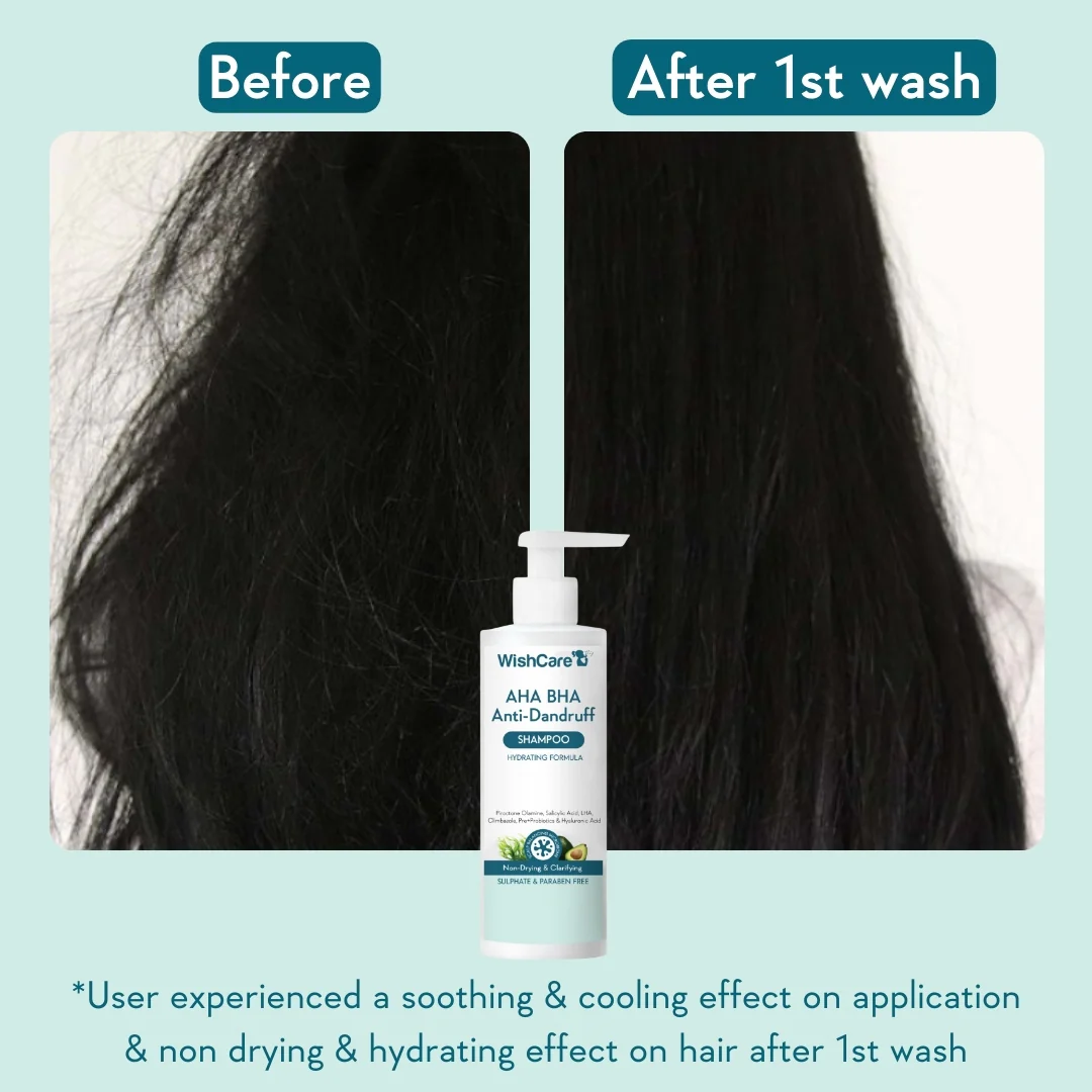 Anti Dandruff Duo - Image 5