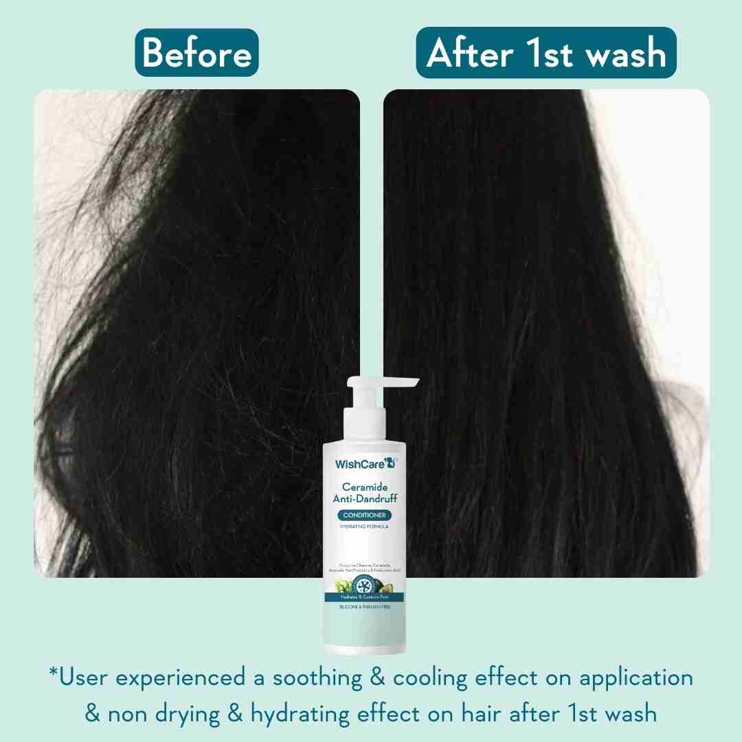 Ceramide Anti-Dandruff Conditioner - Image 3