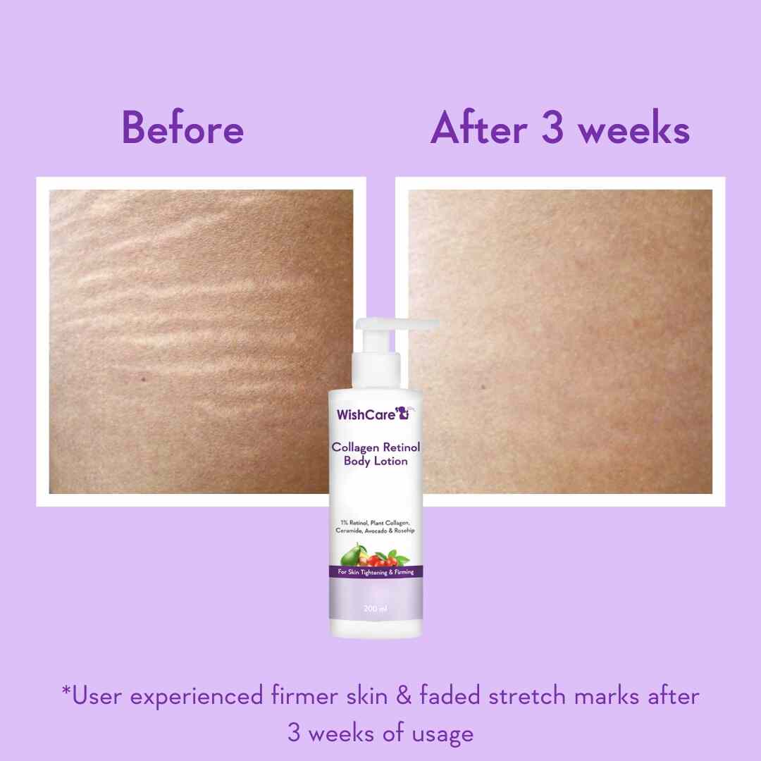 Collagen 1% Retinol Body Lotion - Image 3