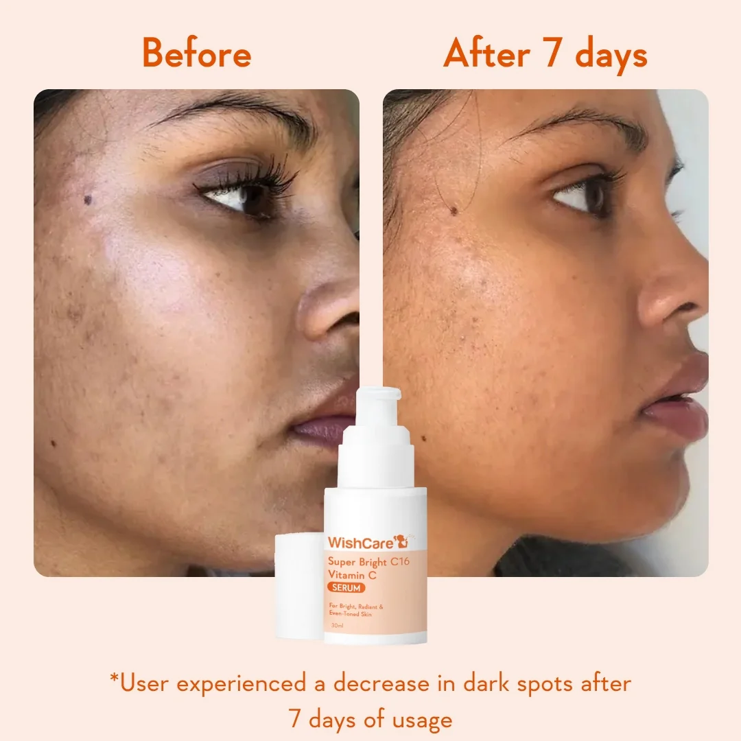 De-pigmentation Duo - Image 4