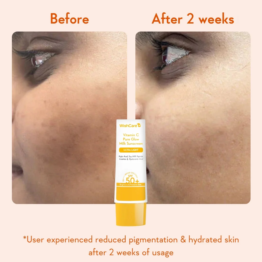 De-pigmentation Duo - Image 5