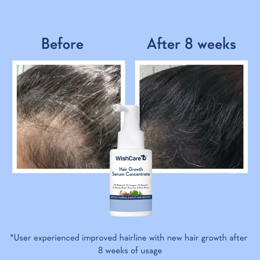 Hair Growth Serum Concentrate - Image 5