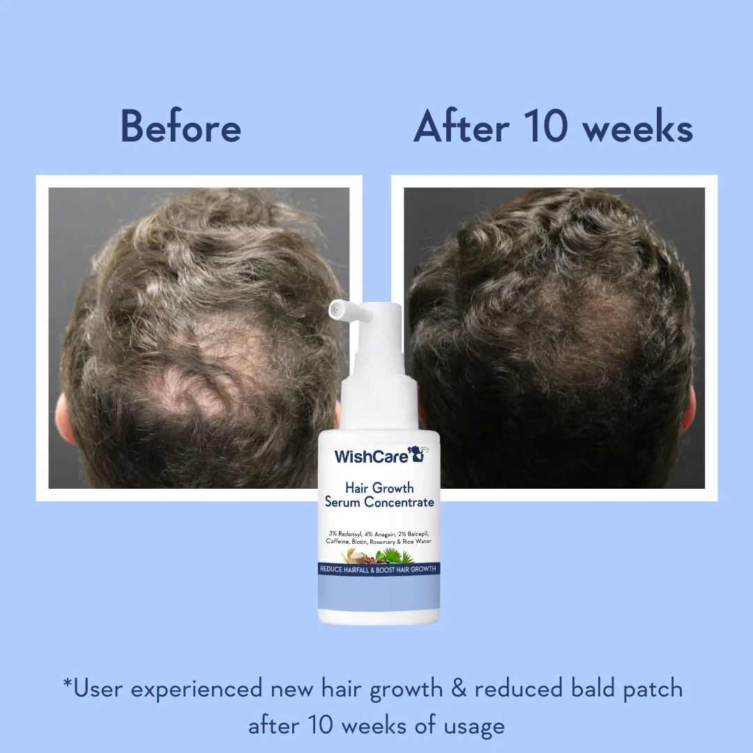 Hair Growth Serum Concentrate - Image 6