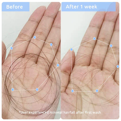 Multi Peptide Anti Hairfall Duo - Image 4