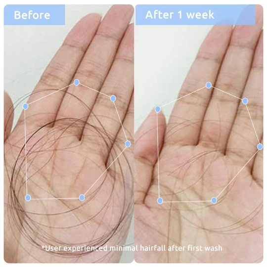 Hair Growth & Anti Hairfall Duo - Image 4