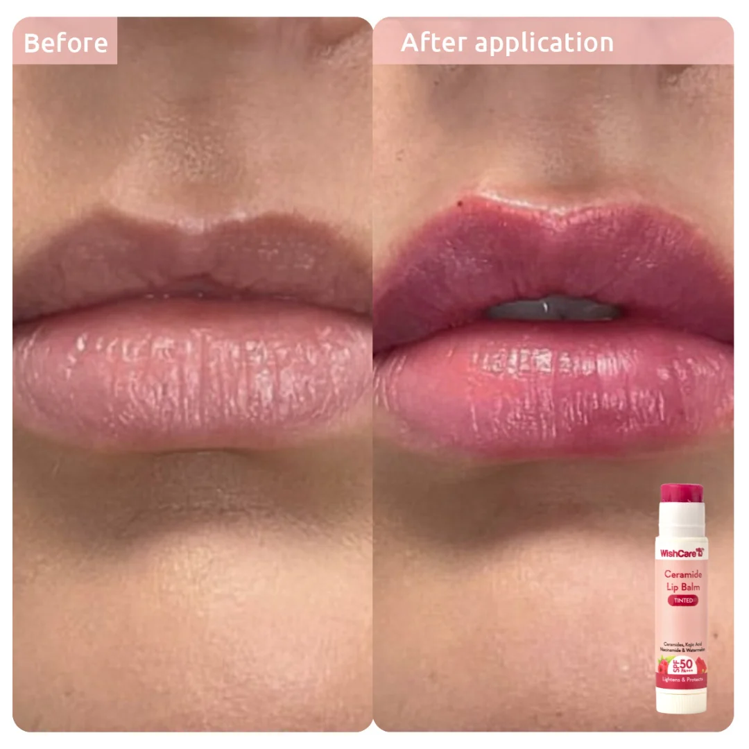 Sunscreen Duo For Face & Lips - Image 5