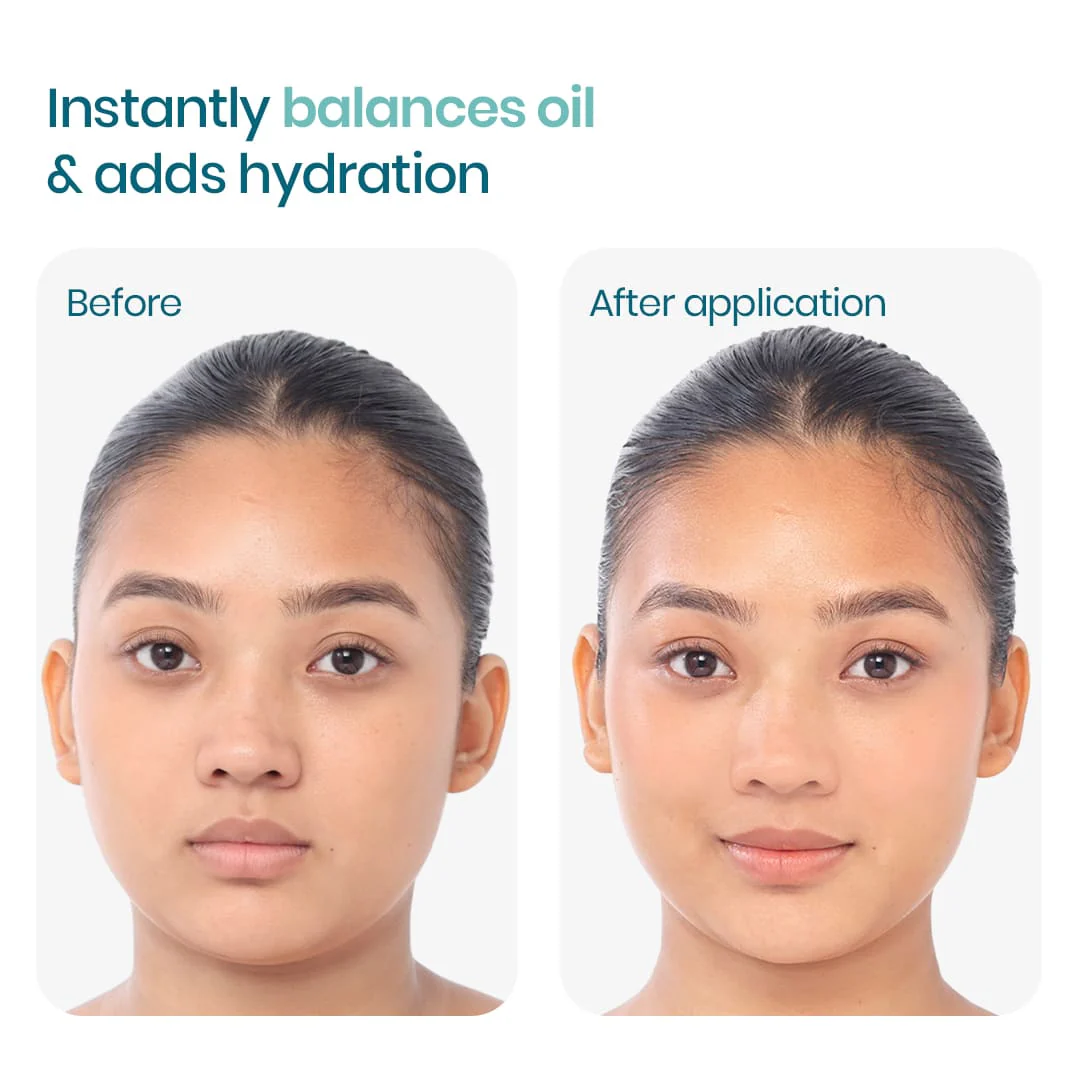 2:1:3 NMF Water Gel Moisturizer - Image 3