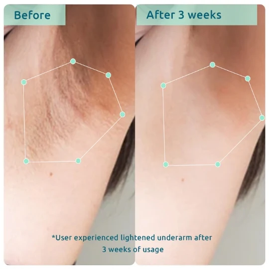 Bodycare Pigmentation Duo - Image 4