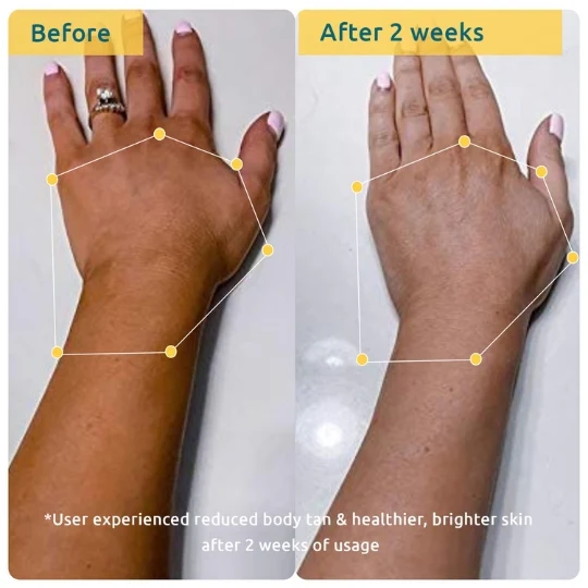 Bodycare Pigmentation Duo - Image 5