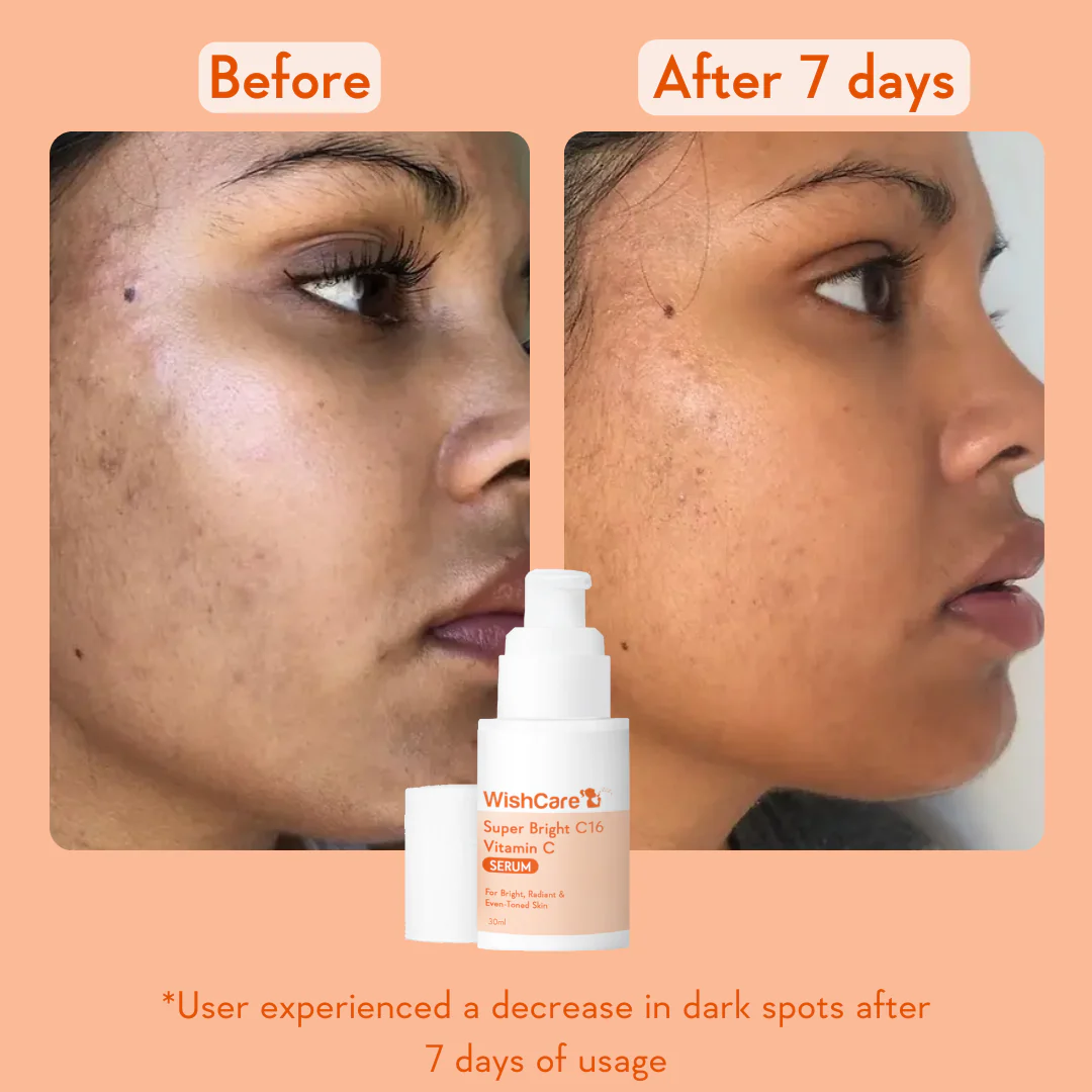 Super Bright Vitamin C16 Serum - Image 3
