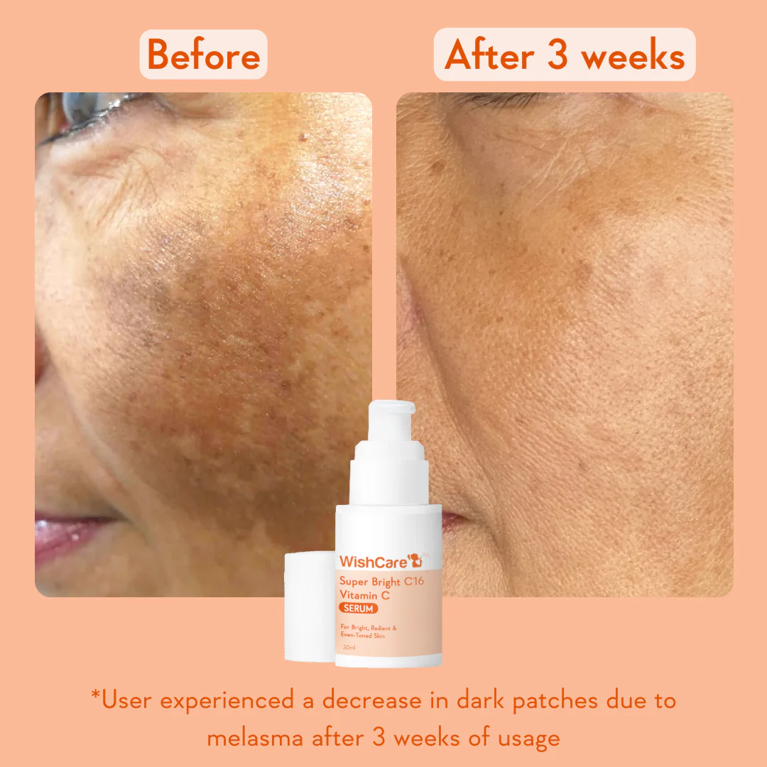 Super Bright Vitamin C16 Serum - Image 5