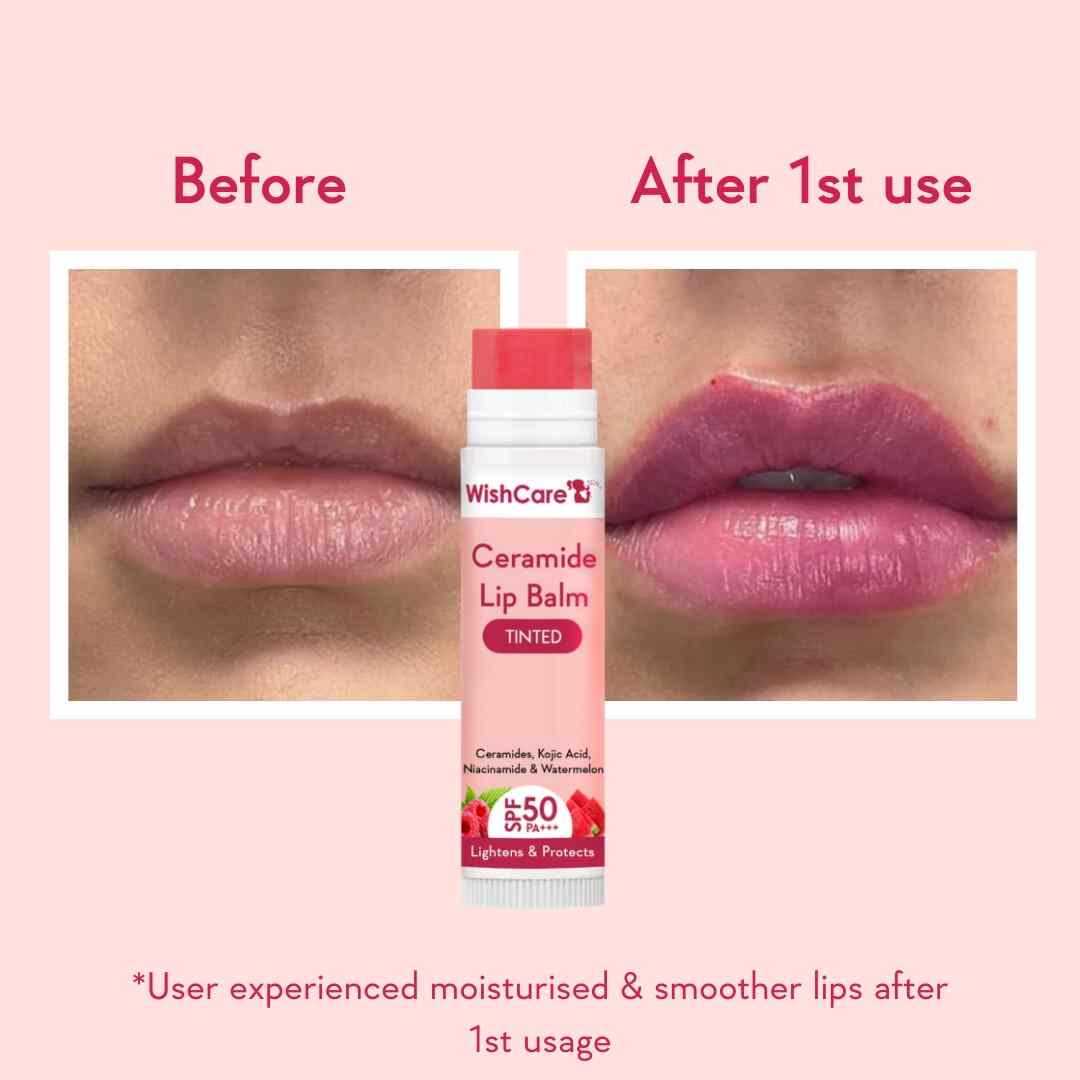 Ceramide Lip Balm with SPF 50 PA+++ (Tinted) - Image 3